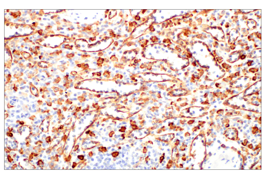 Immunohistochemistry Image 9: CD206/MRC1 (E6T5J) XP<sup>®</sup> Rabbit mAb (BSA and Azide Free)