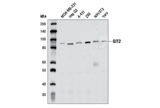 Western Blotting Image 1: GIT2 (D11B8) Rabbit mAb
