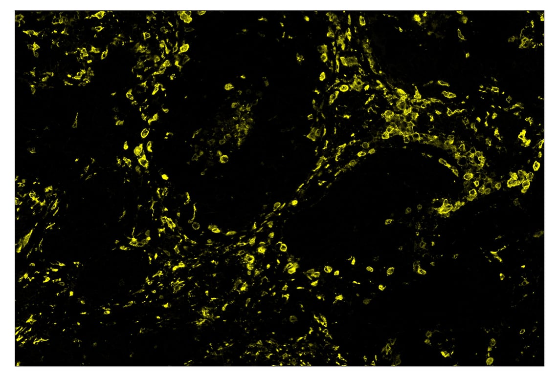 Immunohistochemistry Image 3: CD163 (D6U1J) & CO-0022-488 SignalStar<sup>™</sup> Oligo-Antibody Pair