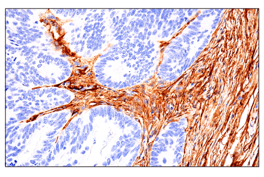 Immunohistochemistry Image 1: CD248 (E9Z7O) XP<sup>®</sup> Rabbit mAb