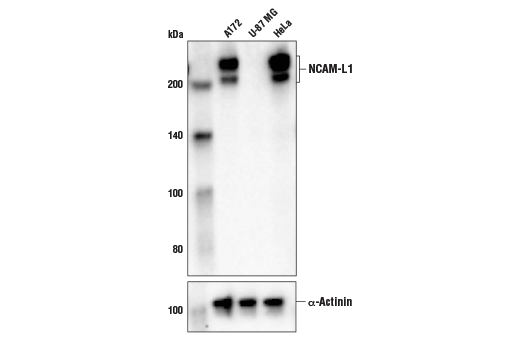 Western Blotting Image 1: NCAM-L1 (D5N9S) Rabbit mAb