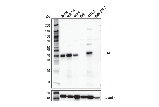 Western Blotting Image 1: LAT (E3U6J) XP<sup>®</sup> Rabbit mAb (BSA and Azide Free)