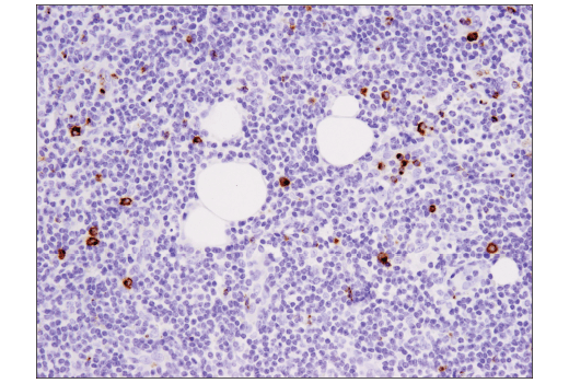 undefined Image 76: Human Exhausted CD8<sup>+</sup> T Cell IHC Antibody Sampler Kit