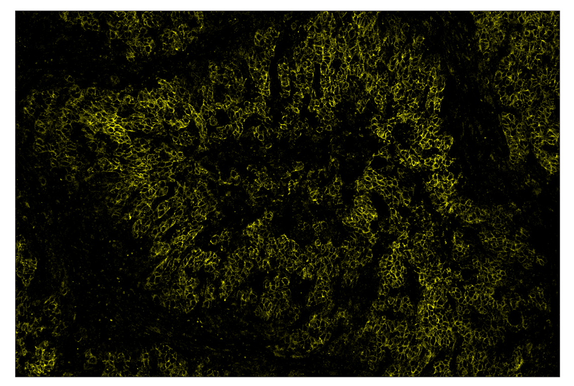 Immunohistochemistry Image 3: HER2/ErbB2 (D8F12) & CO-0059-488 SignalStar<sup>™</sup> Oligo-Antibody Pair