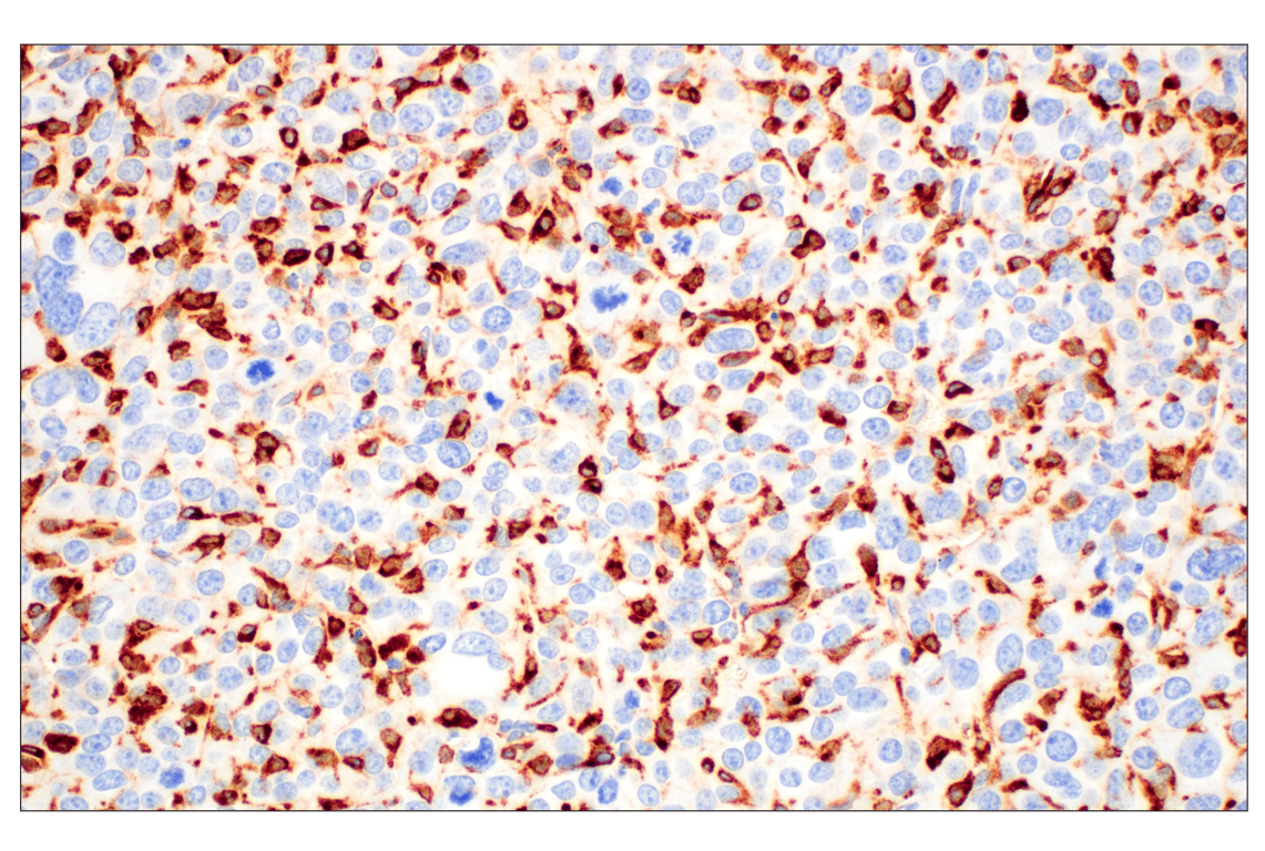 Immunohistochemistry Image 1: C1QB (E3U6X) Rabbit mAb (BSA and Azide Free)