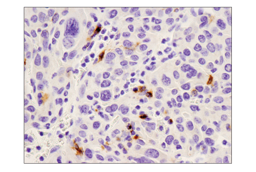 Immunohistochemistry Image 3: PD-L1 (D5V3B) Rabbit mAb (BSA and Azide Free)