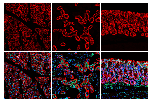 Immunofluorescence Image 1: EpCAM (E8Q1Z) Rabbit mAb