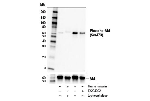 Western Blotting Image 2: Phospho-Akt (Ser473) (E4U3U) Mouse mAb