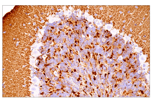 Immunohistochemistry Image 9: α-Synuclein (E4U2F) XP<sup>®</sup> Rabbit mAb (BSA and Azide Free)