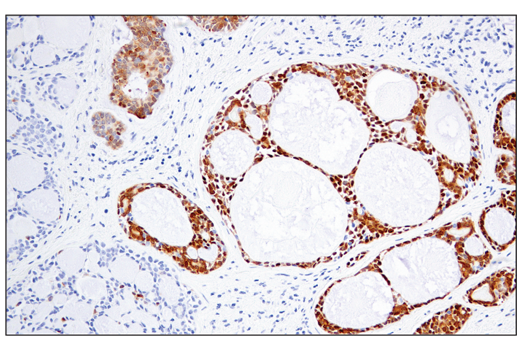 Immunohistochemistry Image 6: MAGE-A4 (E7O1U) XP<sup>®</sup> Rabbit mAb (BSA and Azide Free)