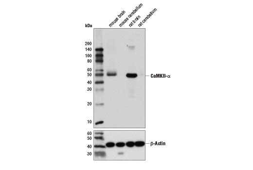 Western Blotting Image 2: CaMKII-α (6G9) Mouse mAb