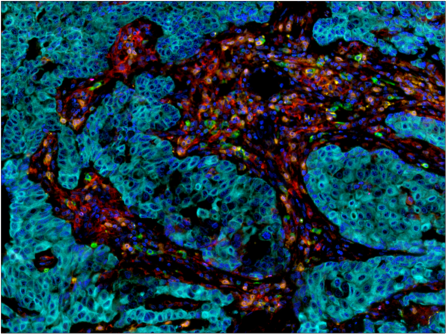 Immunohistochemical analysis of paraffin-embedded spleen using FoxP3 (D6O8R) Rabbit mAb