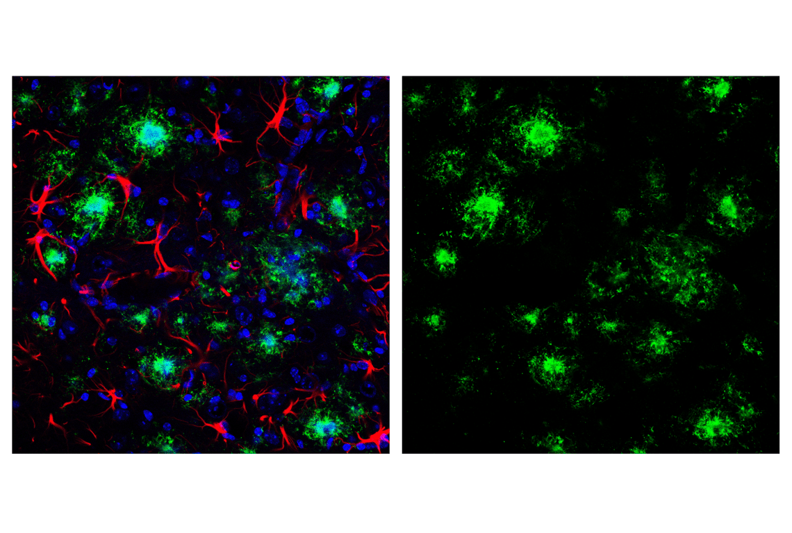 Immunofluorescence Image 1: β-Amyloid (1-42) (E6D5M) Rabbit mAb (BSA and Azide Free)