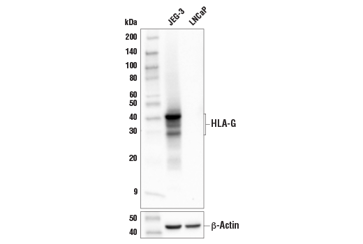 Western Blotting Image 2: HLA-G (E8N9C) XP<sup>®</sup> Rabbit mAb (BSA and Azide Free)