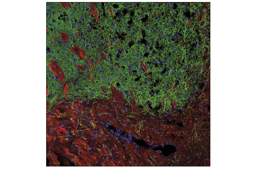 Immunofluorescence Image 1: Tyrosine Hydroxylase (E2L6M) Rabbit mAb