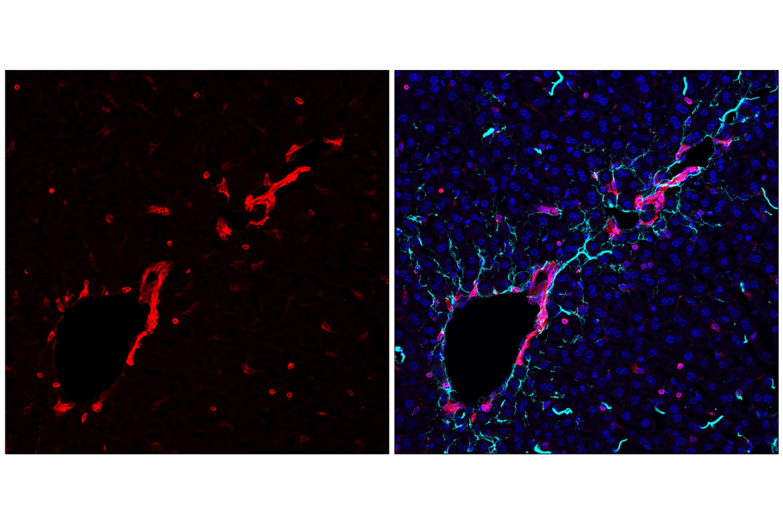 Immunofluorescence Image 1: STING (E9X7F) Rabbit mAb