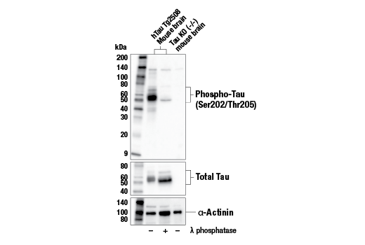 Western Blotting Image 2: Phospho-Tau (Ser202/Thr205) (E6S2W) Rabbit mAb