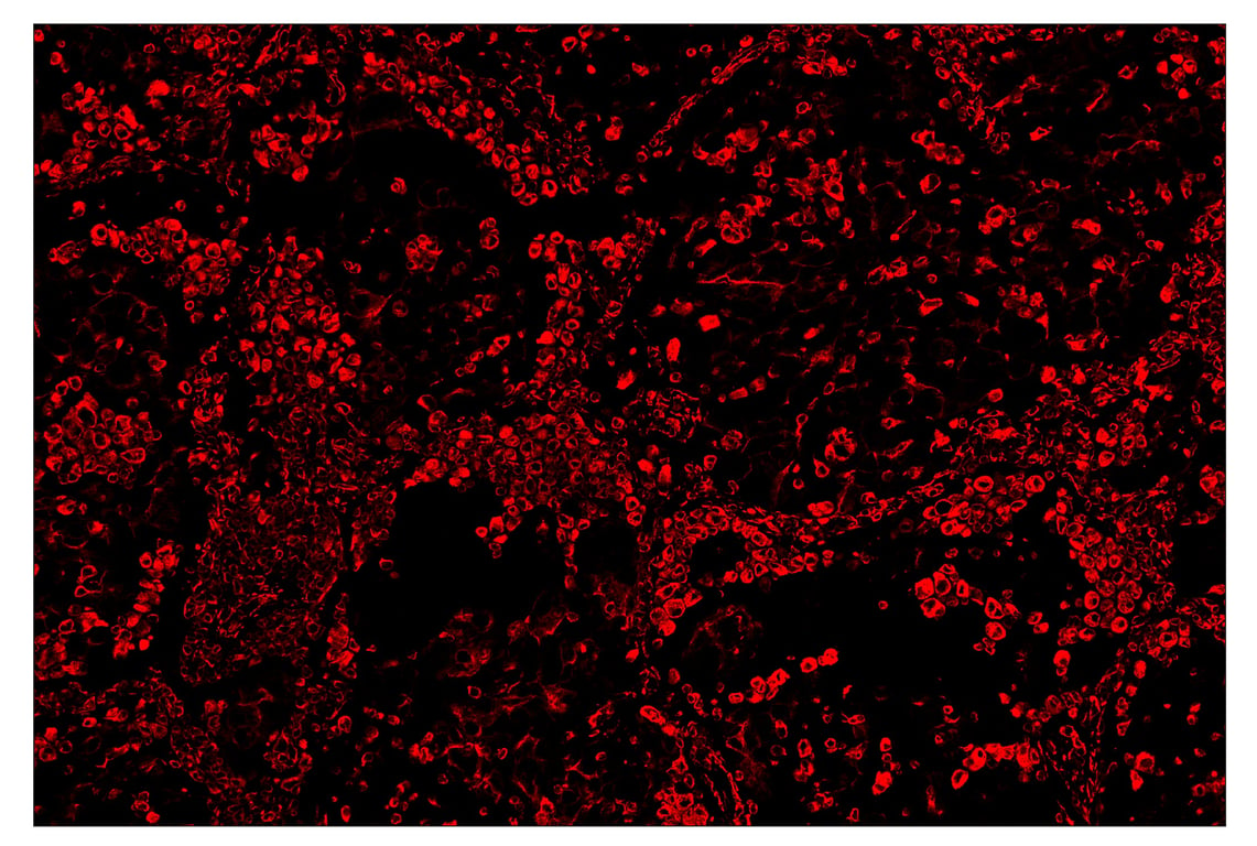 Immunohistochemistry Image 4: Vimentin (D21H3) & CO-0012-647 SignalStar<sup>™</sup> Oligo-Antibody Pair