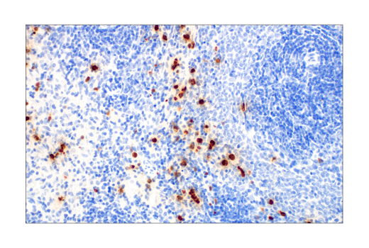 Immunohistochemistry Image 6: S100A9 (D3U8M) Rabbit mAb