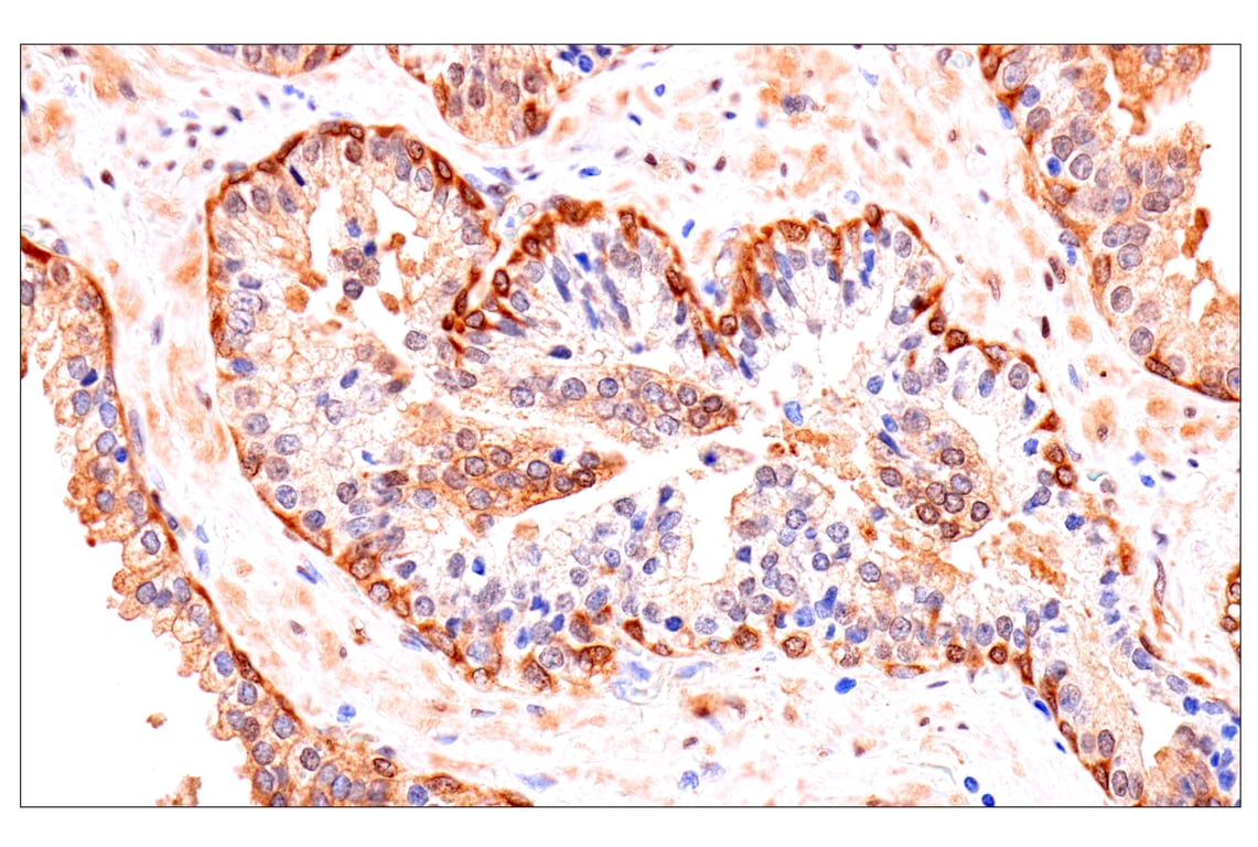Immunohistochemistry Image 3: Phospho-YAP (Ser61) (E4Q8S) Rabbit mAb