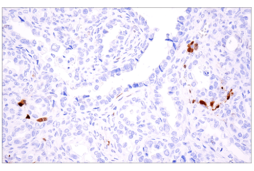Immunohistochemistry Image 7: Calretinin (E7R6O) XP<sup>®</sup> Rabbit mAb