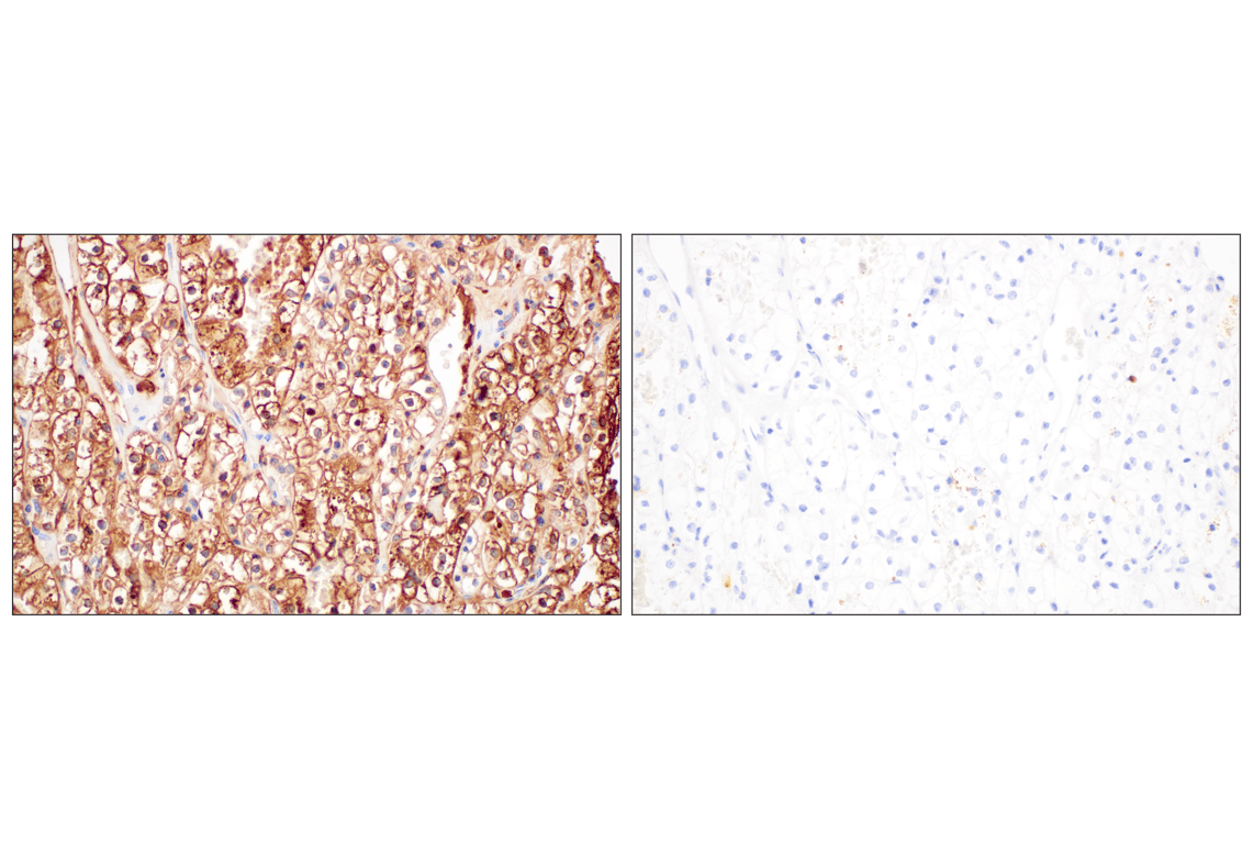 Immunohistochemistry Image 11: FTL (F9O4I) Rabbit mAb