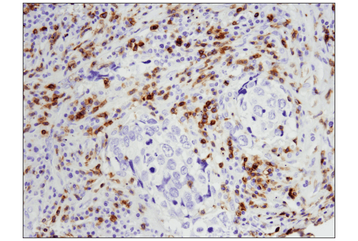 Immunohistochemistry Image 2: CD5 (E8X3S) XP<sup>®</sup> Rabbit mAb (BSA and Azide Free)