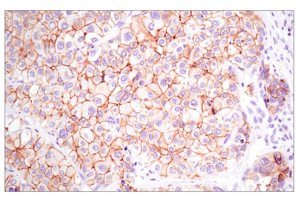Immunohistochemistry Image 2: E-Cadherin (4A2) Mouse mAb (BSA and Azide Free)