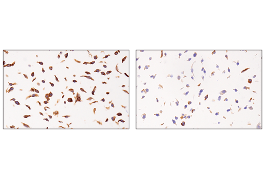 Immunohistochemistry Image 5: APP (E3F3P) Rabbit mAb