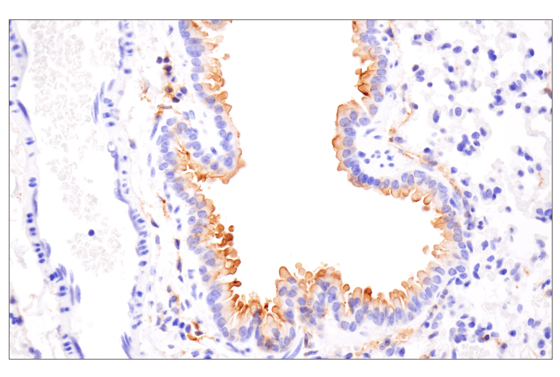 Immunohistochemistry Image 9: CD14 (D1U2Y) Rabbit mAb