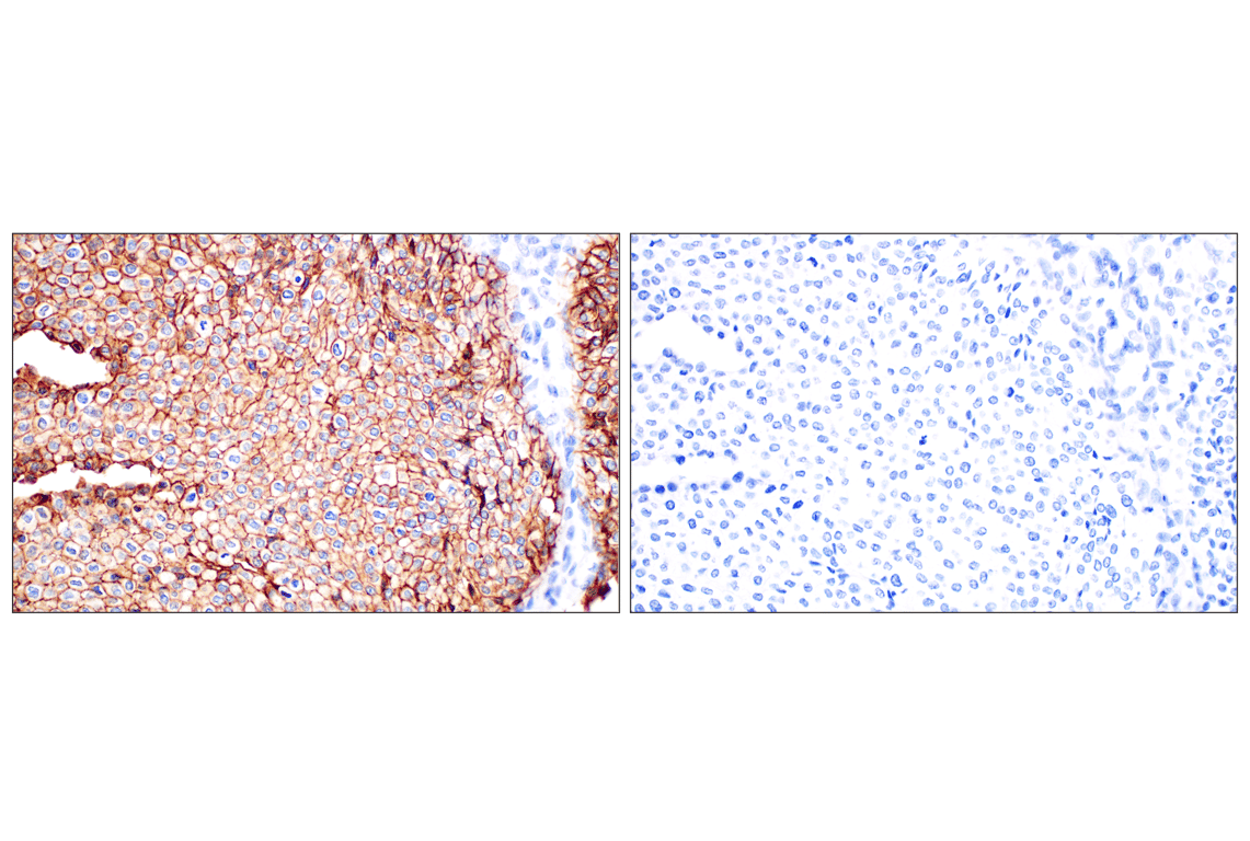 Immunohistochemistry Image 11: TACSTD2/TROP2 (F4W4J) Rabbit mAb (BSA and Azide Free)