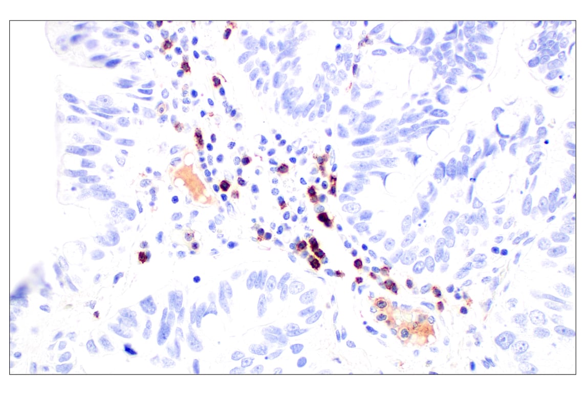 Immunohistochemistry Image 6: CD62L/L-Selectin (E7X9I) Rabbit mAb (BSA and Azide Free)