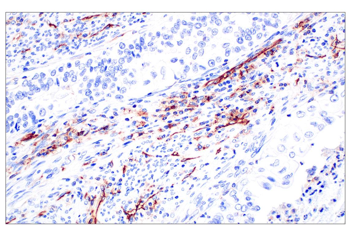 Immunohistochemistry Image 9: CD31 (PECAM-1) (F8M3S) Rabbit mAb (BSA and Azide Free)