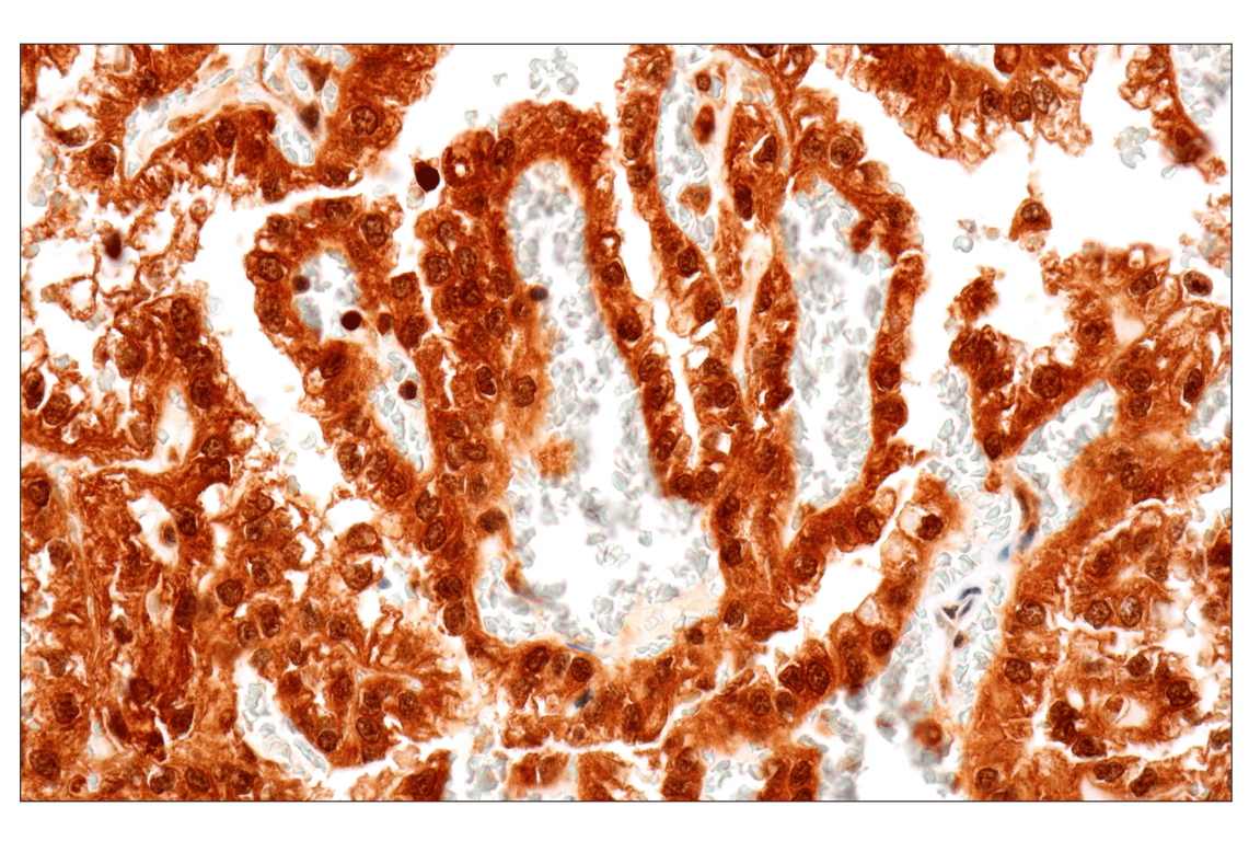 Immunohistochemistry Image 2: MTAP (E5R1I) Rabbit mAb (BSA and Azide Free)