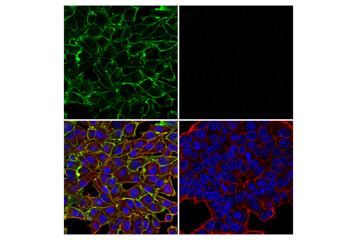 Immunofluorescence Image 1: NG2/CSPG4 (E3B3G) XP<sup>®</sup> Rabbit mAb (BSA and Azide Free)