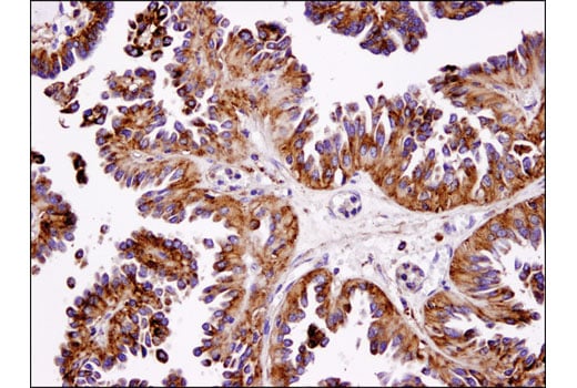 undefined Image 26: PICALM Signaling Antibody Sampler Kit