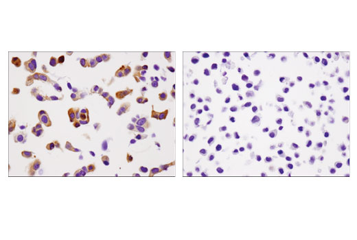 Immunohistochemistry Image 3: INPP4b (D9K1B) XP<sup>®</sup> Rabbit mAb