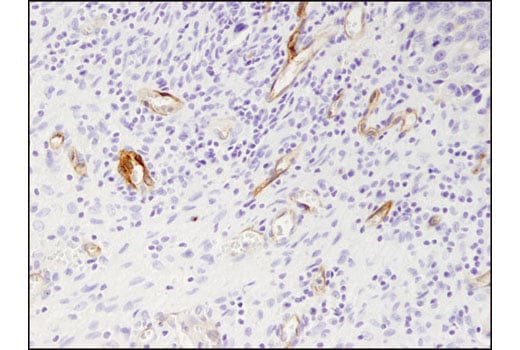 Immunohistochemistry Image 2: Prostate Specific Membrane Antigen (D7I8E) XP<sup>®</sup> Rabbit mAb (BSA and Azide Free)
