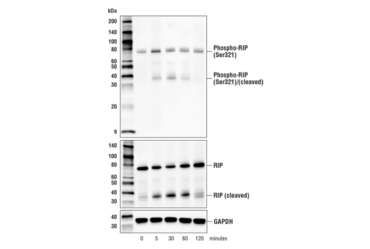 Western Blotting Image 1: Phospho-RIP (Ser321) (E9K2A) Rabbit mAb