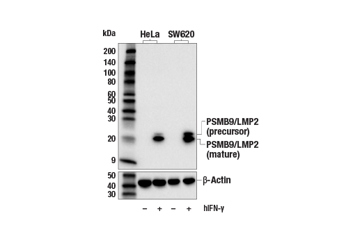 Western Blotting Image 1: PSMB9/LMP2 (E7J1L) Rabbit mAb