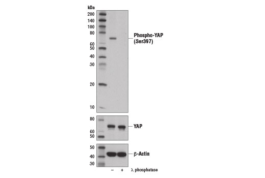 Western Blotting Image 1: Phospho-YAP (Ser397) (D1E7Y) Rabbit mAb (BSA and Azide Free)