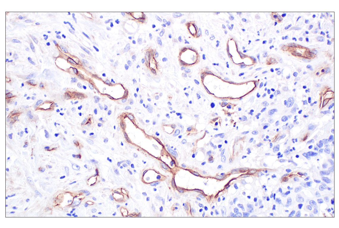Immunohistochemistry Image 1: CD105/Endoglin (F9C5Q) Rabbit mAb
