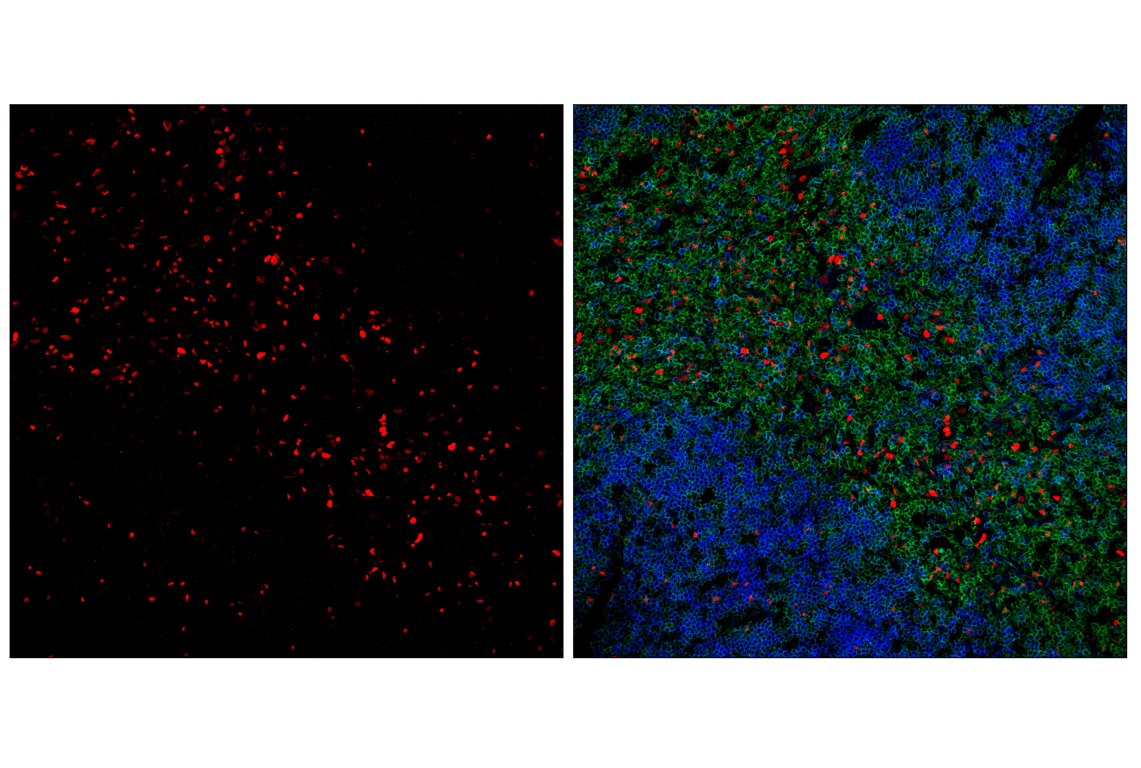 Immunofluorescence Image 1: T-bet/TBX21 (E4I2K) Rabbit mAb (Alexa Fluor<sup>®</sup> 555 Conjugate)