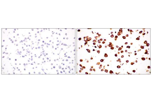 Immunohistochemistry Image 12: LAMP3/CD208 (E6E5U) XP<sup>®</sup> Rabbit mAb (BSA and Azide Free)