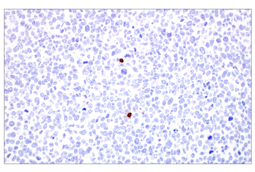 Immunohistochemistry Image 1: CD20 (E3N7O) XP<sup>®</sup> Rabbit mAb