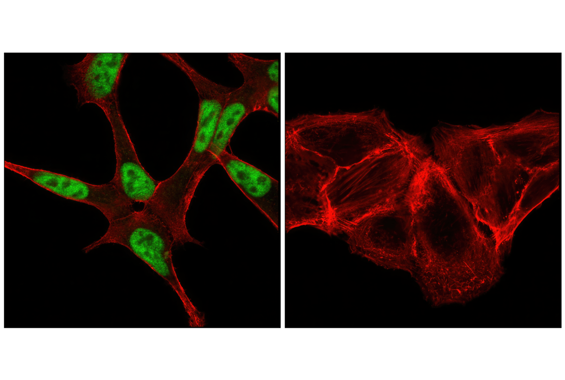 Immunofluorescence Image 1: Androgen Receptor (D6F11) XP<sup>®</sup> Rabbit mAb (BSA and Azide Free)