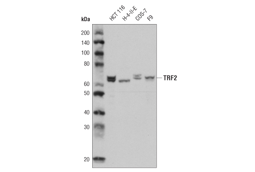 Western Blotting Image 1: TRF2 (D1Y5D) Rabbit mAb