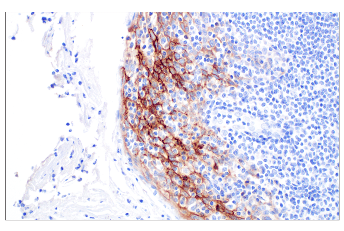 Immunohistochemistry Image 9: CD44 v5 (C44Mab-3) Mouse mAb
