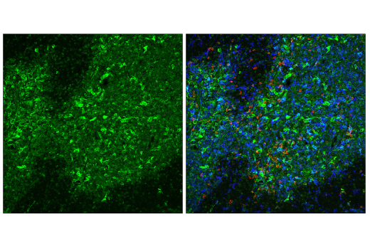 Immunofluorescence Image 2: STING (E9X7F) Rabbit mAb (Alexa Fluor<sup>®</sup> 488 Conjugate)