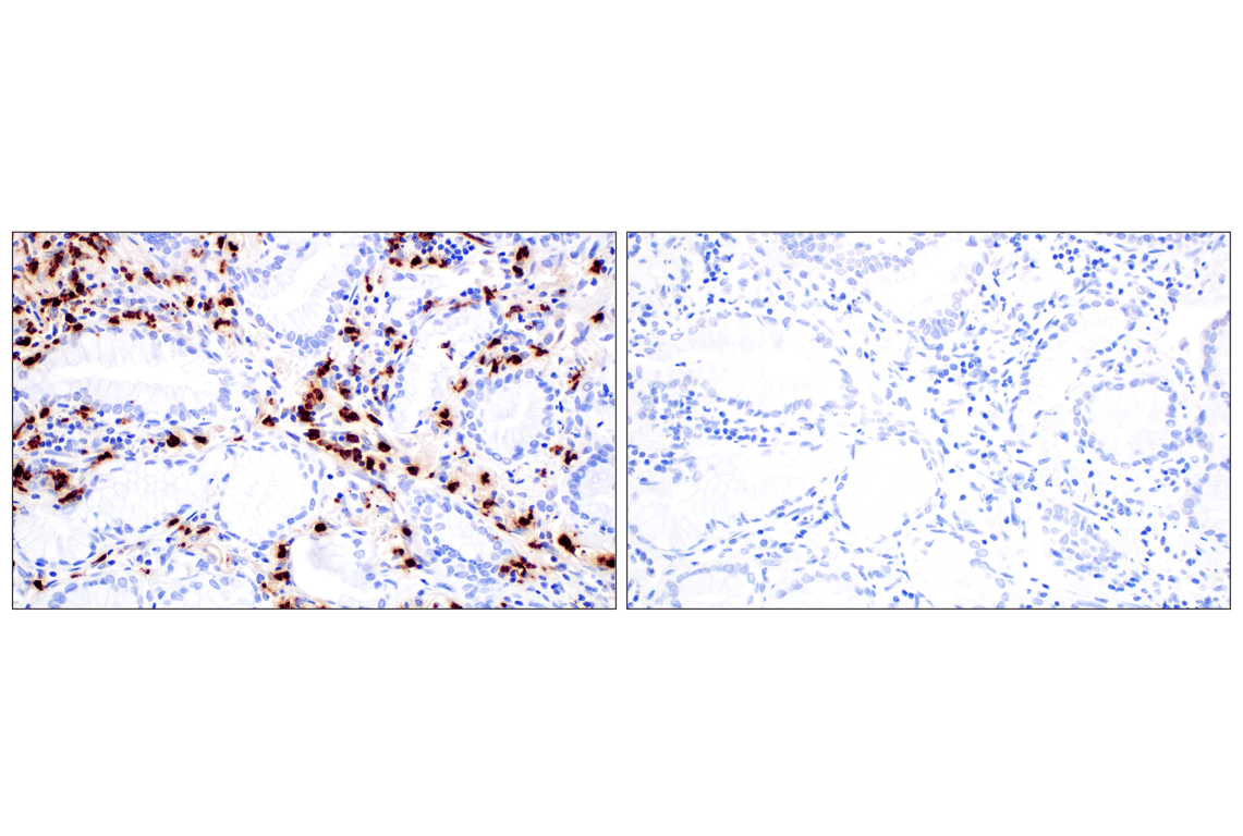 Immunohistochemistry Image 10: Neutrophil Elastase (F4H3X) Rabbit mAb (BSA and Azide Free)